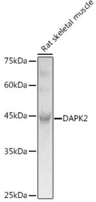 Western Blot DAP Kinase 2 Antibody - Azide and BSA Free